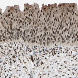 PML Protein Antibody, Novus Biologicals:Antibodies:Primary Antibodies